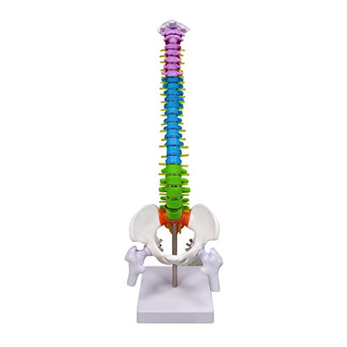 Една от най-съвременните Умален модел на човешкото гръбначния стълб, 15,5 Мини-Цветен Гръбначния мозък с херния на диска,