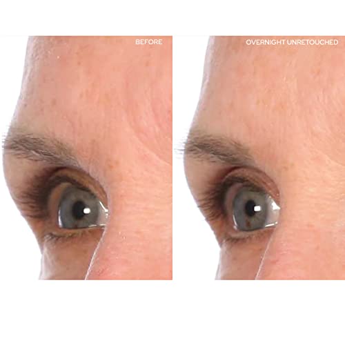SiO Beauty пластир против бръчки на челото от средата на веждите - силикон лепенка бързо многократна употреба на нощ за намаляване